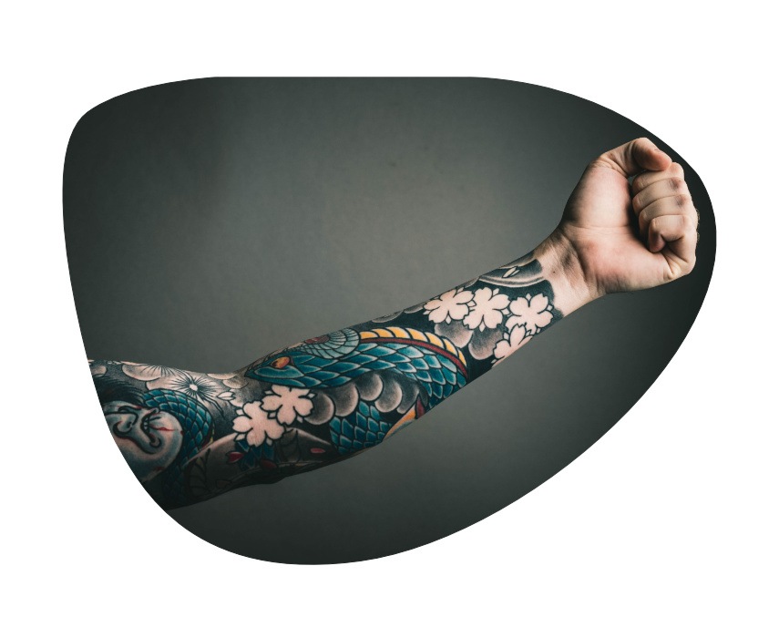eliminacion de tatuajes las palmas eliminacion de tatuajes las palmas