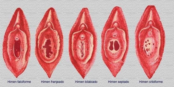 que-es-el-himen que-es-el-himen