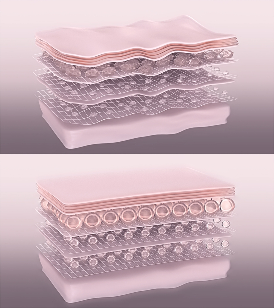 LIPODEFINE Capas de la piel antes y después del tratamiento con inductores colágeno