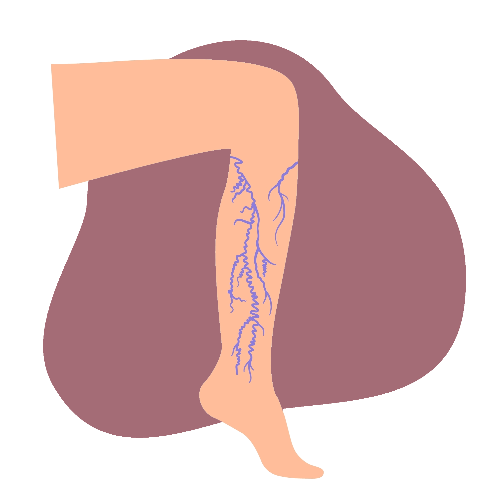 dibujo de ejemplo de lesiones vasculares, varices